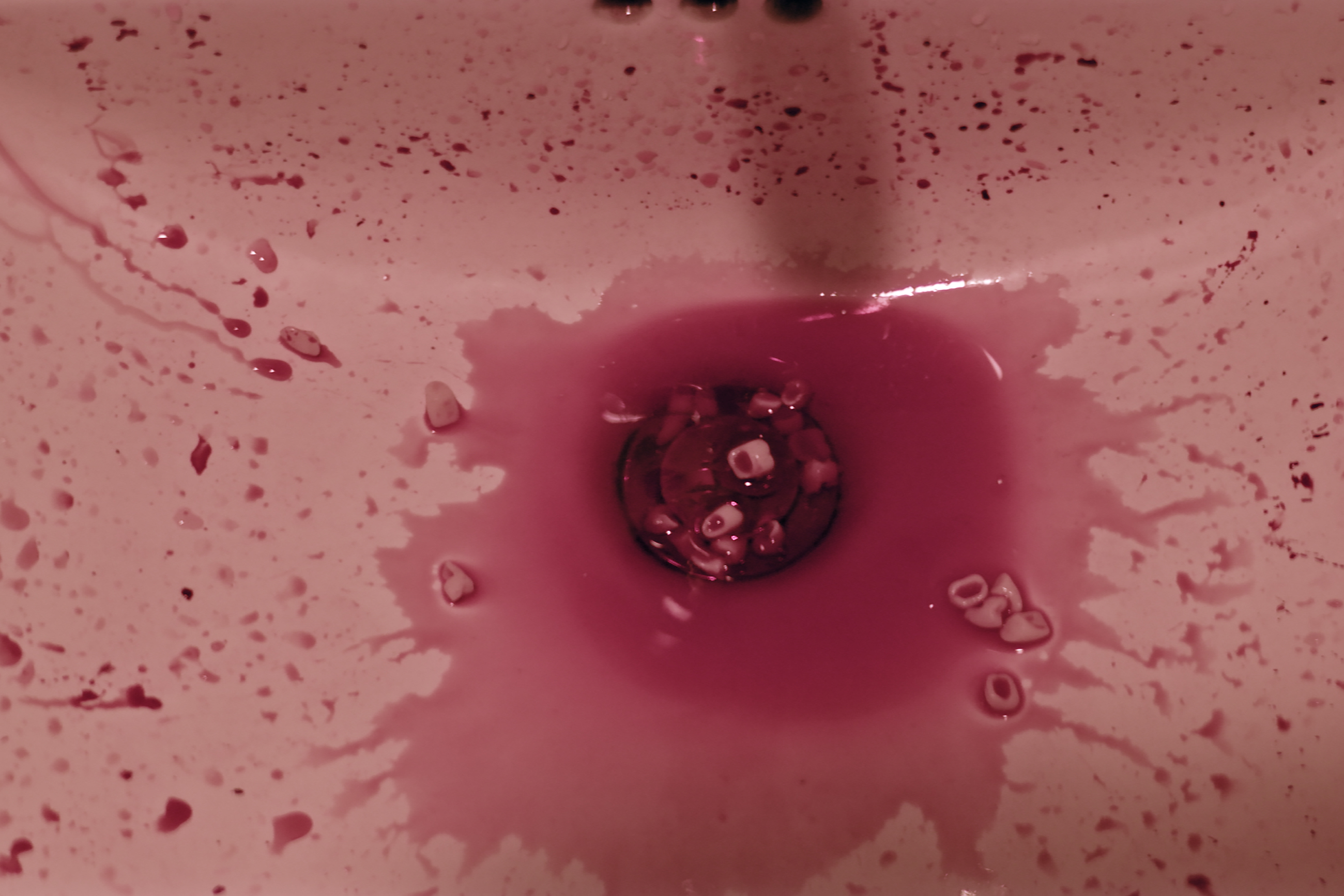 still from Aiden Kelly film showing bloody teeth in the bathroom sink