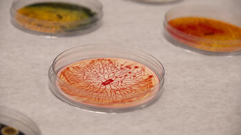 three petri dishes featuring printed images on their inner surface, sitting on a white surface