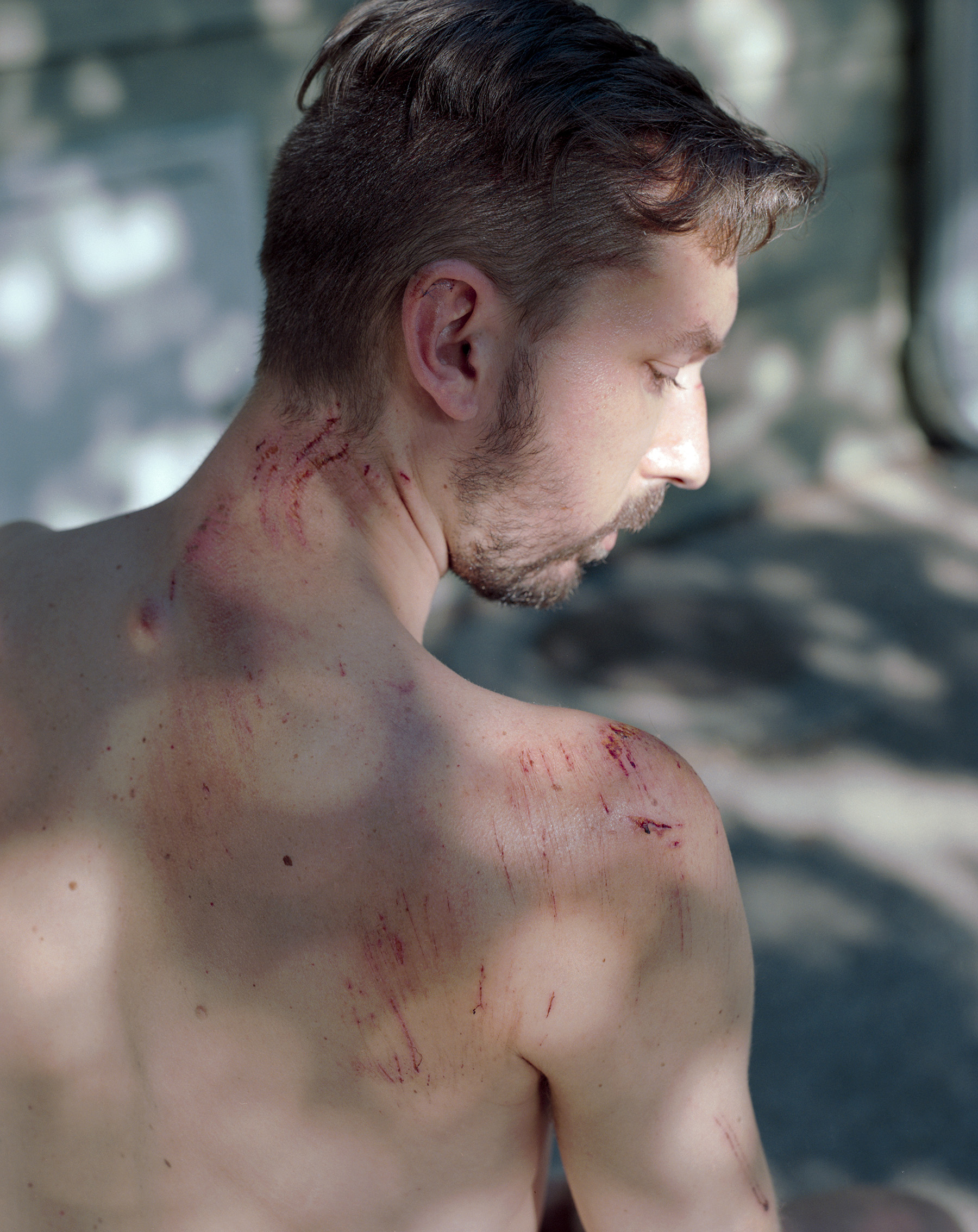 photograph of a man whose back is all scratched and bloody