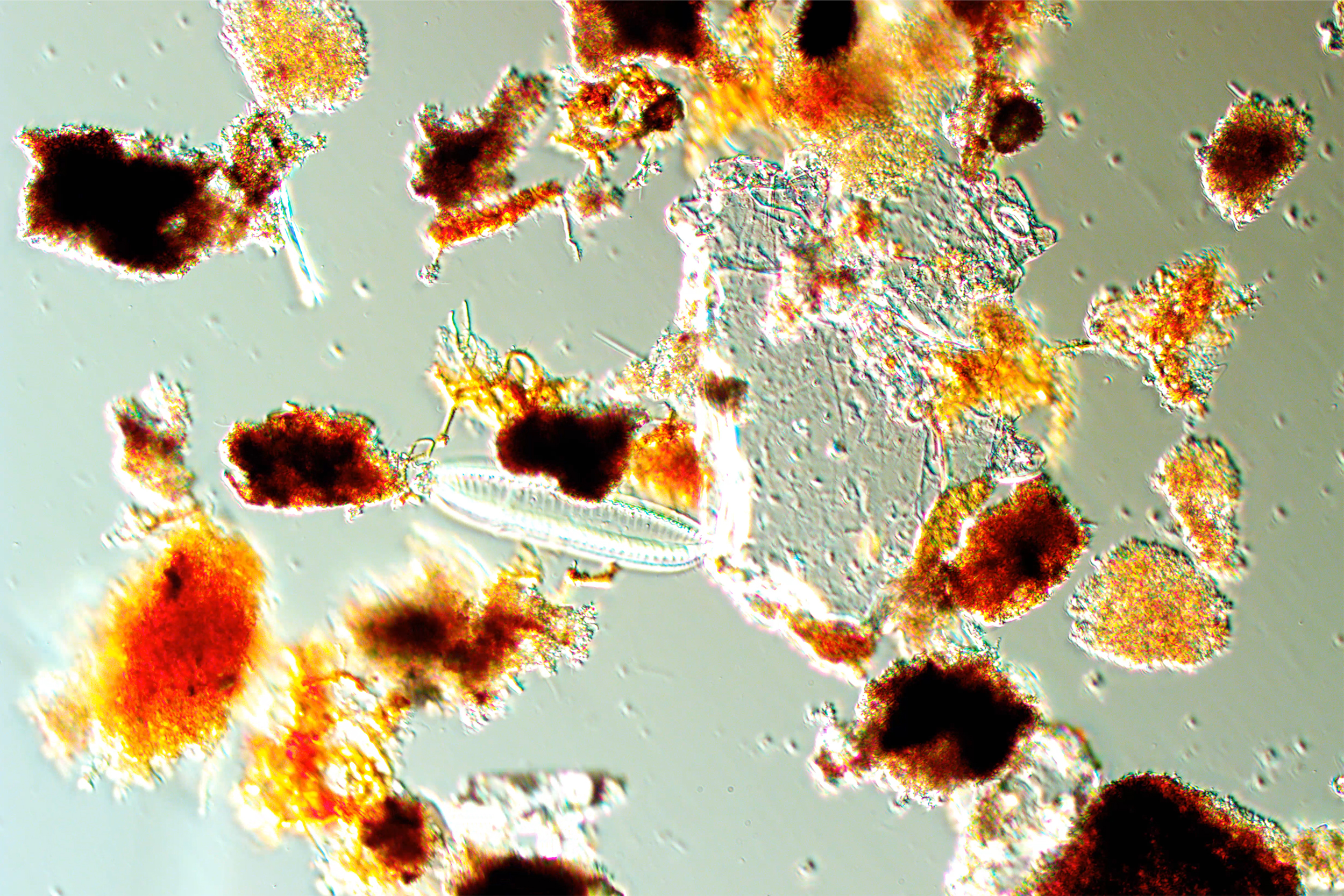 view of water samples through the microscope