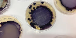bacteria growing in petri dishes
