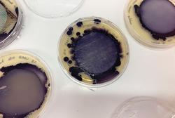 several Petri dishes containing purple-hued bacteria samples